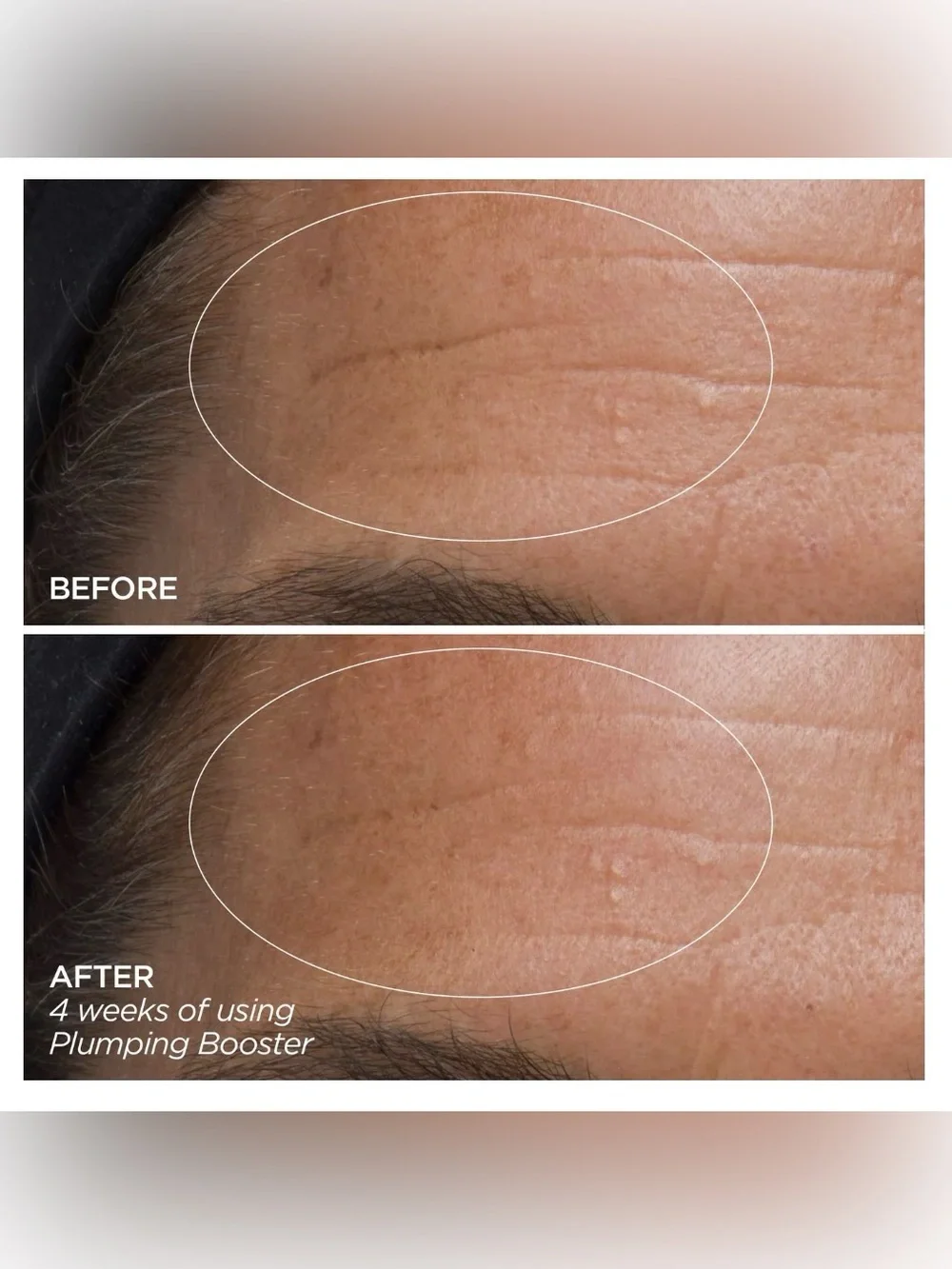 BEAUTYBIO Plumping Booster Hyaluronic Acid Supercharged Complex
